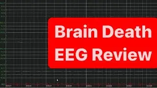 Brain Death EEG Review