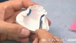 DurAcetal Frameworks