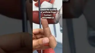 Cost of Artificial Finger in India | Finger Prosthesis | Prosthetic Fingers #finger