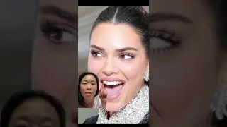 Does Kendall Jenner have dental veneers? Veneercheck