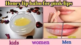 honey lip balm for pink lips / homemade honey lip balm for kids / Lip balm / for dark pigmented lips