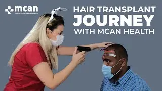 FAMOUS RUGBY PLAYER&rsquo;S HAIR TRANSPLANT JOURNEY WITH MCAN HEALTH