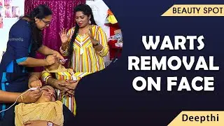 Warts Removal on face | Prevention and Treatment | Beauty | Kaumudy