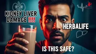 Does Herbalife Really Damage Liver & Kidney? | The Truth About Nutrition & Lifestyle | FITNESSMUNAF
