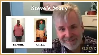 Steve's Journey To Losing 173 lbs With The Sleeve Clinic