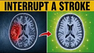 Do THIS to AVOID a Stroke (It Destroys the Brain) - Japan's Oldest Doctor: