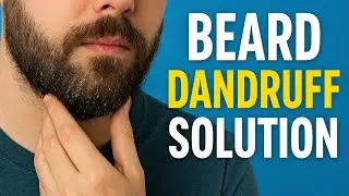 Beard Dandruff? Try This Home Remedy (7 Days Result)
