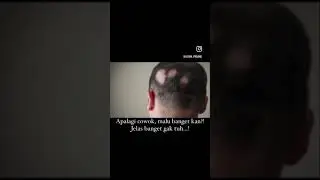 Awas botak koin