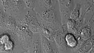 How do cancer cells divide?