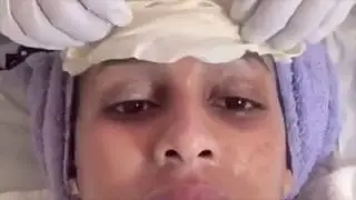 BB Glow treatment semi-permanent foundation Micro needling