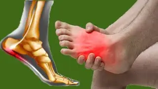 STOP Plantar Fasciitis Pain: 5 Simple Home Fixes
