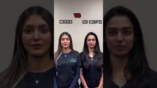 Botox or no botox face! #botox #nobotox #viral #famous #preventativebotox #botoxmeme #botoxcosmetic