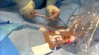 Femoral CVC & Artline Insertion