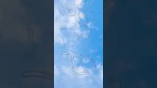 Откуда берутся мушки перед глазами 👀