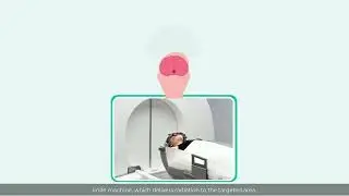 Gamma Knife Surgery: How It Works, Advantages, Expanding Scope of Treatments