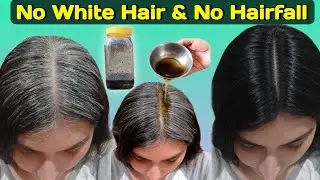 White Hair Kaise Thik Kare | Safed Baal Ka Ilaj | Premature Grey Hair Solution Home Remedy #grayhair