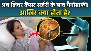 Dipika Kakar Mammography Test: Mammography क्या होता है, Types & Side Effects | Boldsky