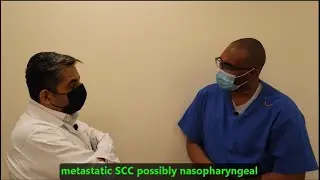 Head & Neck CA 2 I Case1: Tongue CA I Case2: Oropharynx CA I Case3: Relapse I Case 4: Nasopharynx CA