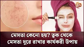 মেসতা কেনো হয়? ত্বক থেকে মেসতা দুরে রাখার কার্যকরী উপায় | Mesta | Channel 24