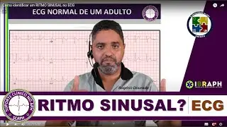 Como identificar um RITMO SINUSAL no ECG | Todo profissional de APH tem que saber pelo o menos isso