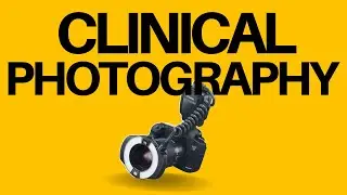 My secrets to Clinical Photography - from Basic to Professional (Medicine, Dentistry, Surgery)