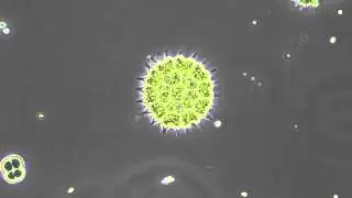 Pediastrum