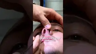 РИНОПЛАСТИКА В МАХАЧКАЛЕ - АЛИ РАДЖАБОВИЧ Узнать стоимость или записаться по тел. 79882925115