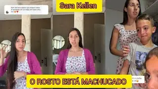 SARA KELLEN MOSTROU COMO ESTÁ O ROSTO DO JOÃO
