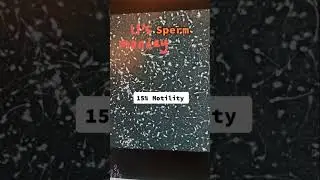 Motility is the percentage of sperm that are moving. #monday #mentalhealth #fertility #ttc