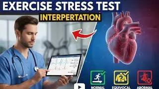 TMT (Treadmill test/Exercise Stress Test ) Interpretation 