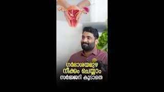 ഗര്ഭാശയമുഴ നീക്കം ചെയാം സര്ജറി  കൂടാതെ  | Uterus Fibroid Embolization | KIMS ALSHIFA