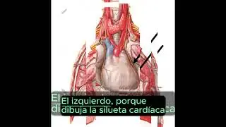 Anatom&iacute;a-Nervio Fr&eacute;nico.
