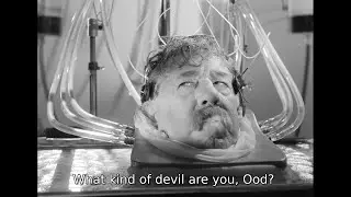 The Head (1959) Blu-Ray, Great Picture