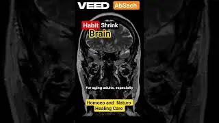 Habits that shrink your Brain l Sitting for long is harmful for your Brain l #AbSach #habits #brain