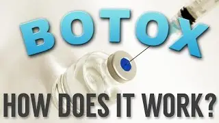 Botox. How long does it take to work?