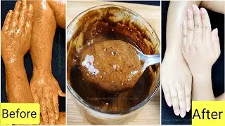 World's Best Hands/Feet Whitening | In Winters At Home !
