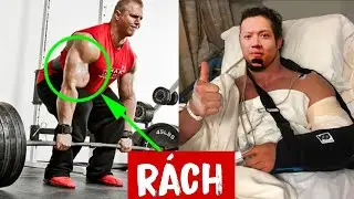 Seri Thứ 3 Kĩ thuật | Mixed Grip v&agrave; c&aacute;c vấn đề về MẤT C&Acirc;N BẰNG (Muscle Imbalances) | SmallGym