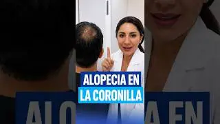 Alopecia en la Coronilla de la cabeza - #Calvicie
