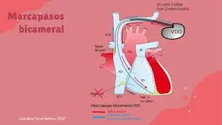 Implantes de marcapasos, cuidados y complicaciones