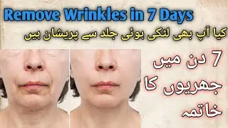 How To Remove Wrinkles On Face | Best Anti Aging Skincare Products 💯 Results&nbsp;