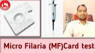 HOW TO DO MICRO FILARIA(MF) CARD TEST PROCEDURE||