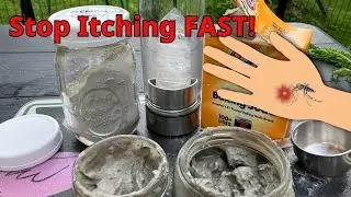 Bug Bite Relief: Natural Remedies That Actually Work!