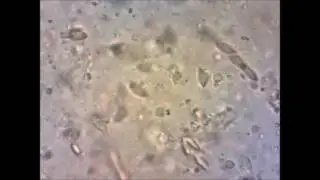 Parasites Observed in the Intestinal Tracts of Marine Tropical Fishes