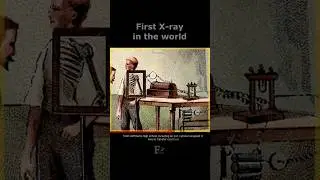 The first X-ray machine in the world #xray #history #oldest #facts