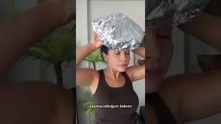 Sa&ccedil; Uzatma Ser&uuml;venim 🌿 | DAX SuperGro & Mossi Gummies Deneyimim 💆🏻&zwj;♀️✨