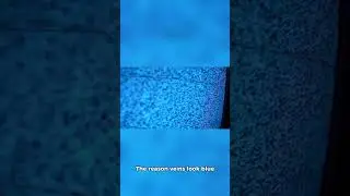 Deoxygenated Blood is Blue?