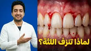Why do gums bleed?