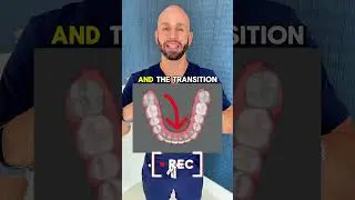 Invisalign to get straight teeth