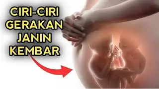 Unik! Ini Ciri-ciri Gerakan Janin Kembar yang Perlu Bumil Ketahui
