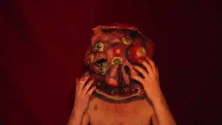 Stuck In My Skin